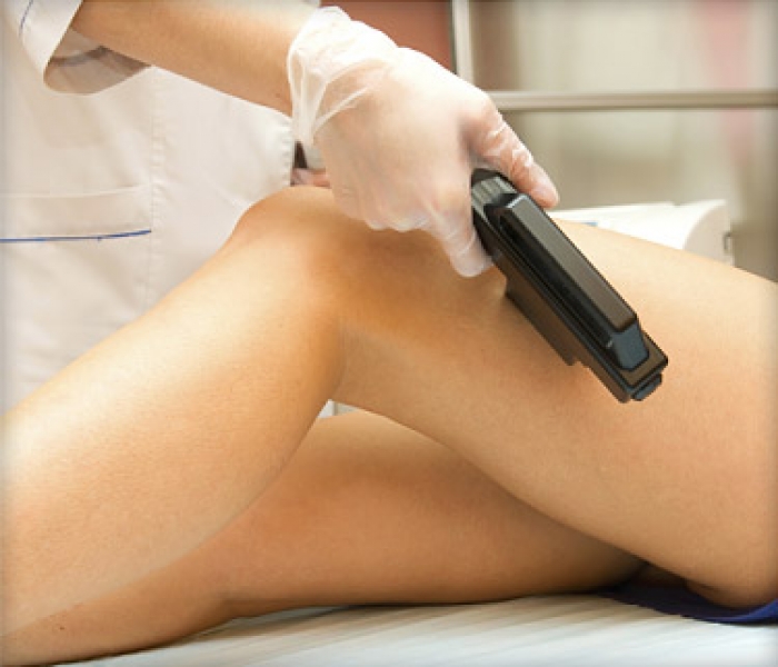 Laser Hair Removal